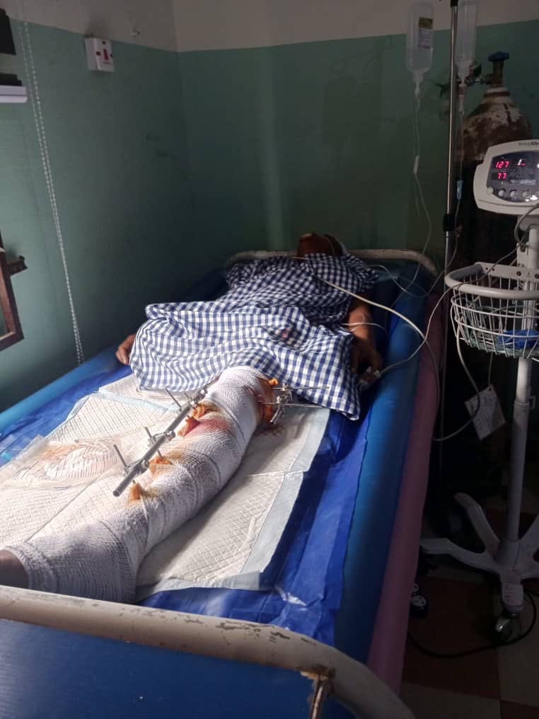 Dangote Truck Accident: BBNaija Star Phyna’s Sister Suffers Leg Amputation